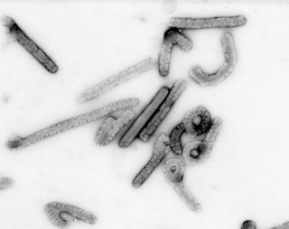 Illustration for article titled This Ebola-Type Fever is Named After a Town in Germany